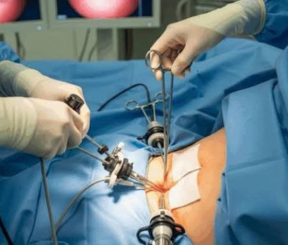 Hernia Treatment Consultation