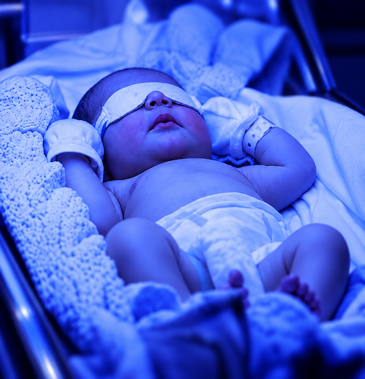 Phototherapy Treatment